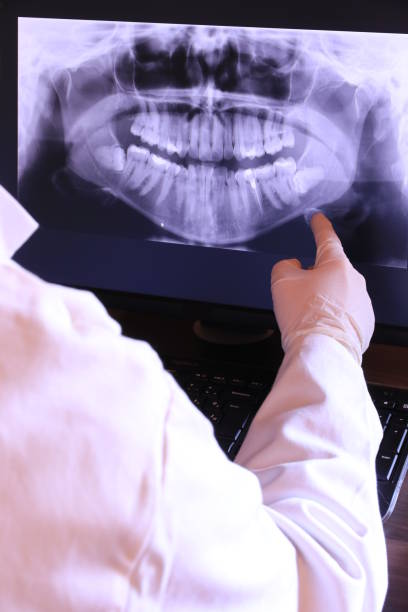 Best Broken Tooth Emergency  in St John, IN
